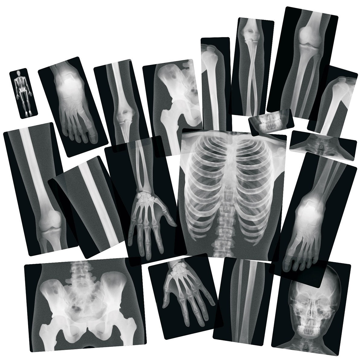 True to Life Human X-Rays, True to Life Human X-Rays,school resources, resources for children, reception resources, True to Life Human X-Rays,Hold these life-size human x-rays up to the light or use them on a light table to reveal every authentic detail of a real skeleton. Arrange the 28 pieces together to reproduce the entire skeleton of a young adult (1.5m tall). Learn to identify the different teeth and see how firmly they are rooted, put your hand alongs,True to Life Human X-RaysHold these life-size hum